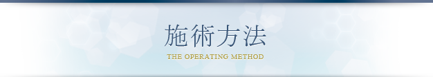 施術方法